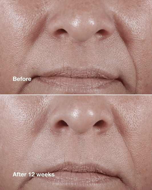 Clinique Smart Clinical Repair™ Wrinkle Correcting Rich Cream - US 0268