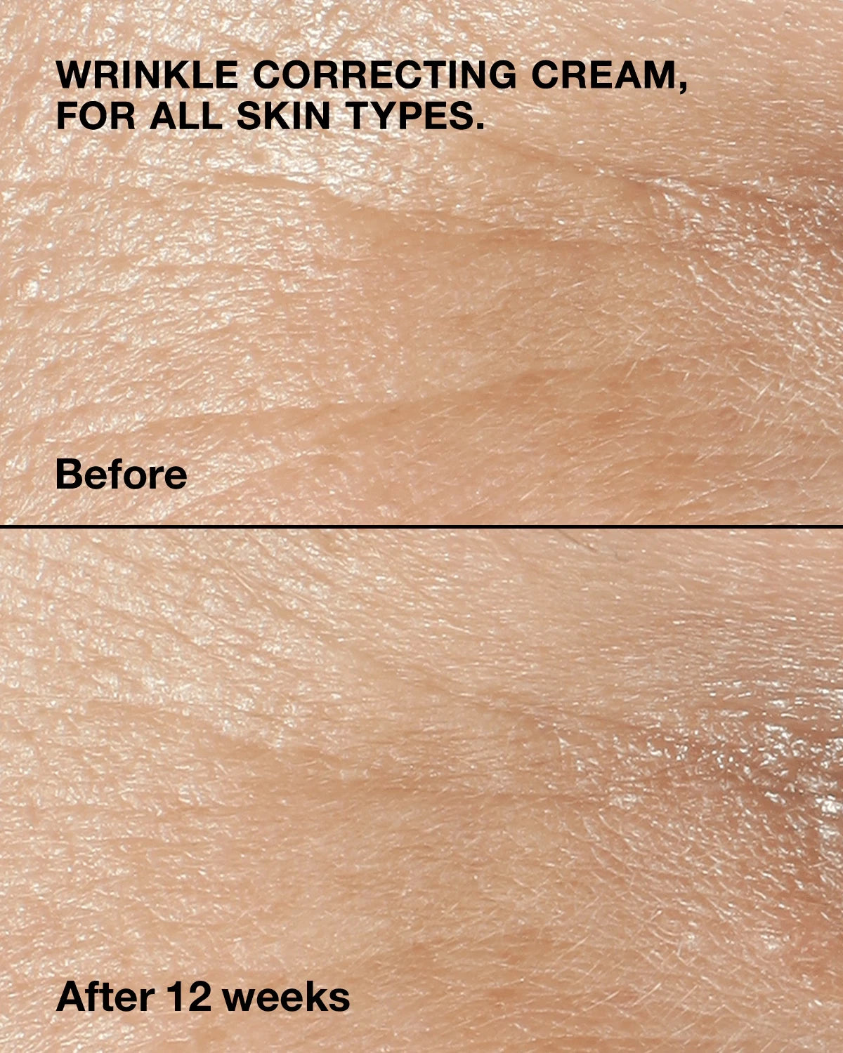 Anti-Aging Routine Skincare Set - US 3745