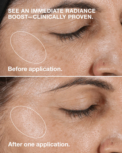Clarifying Lotion 2 - US 7725