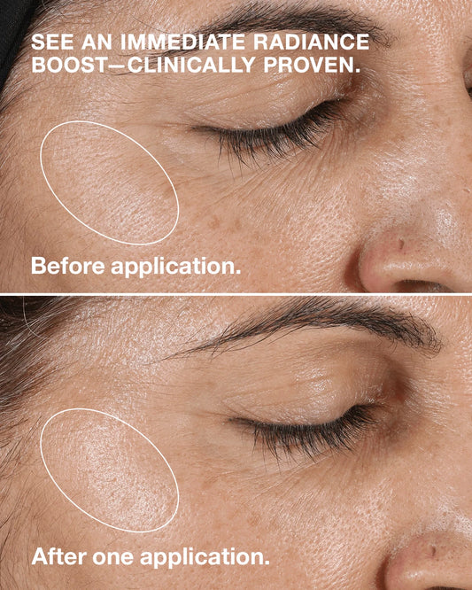 Clarifying Lotion 2 - US 7725