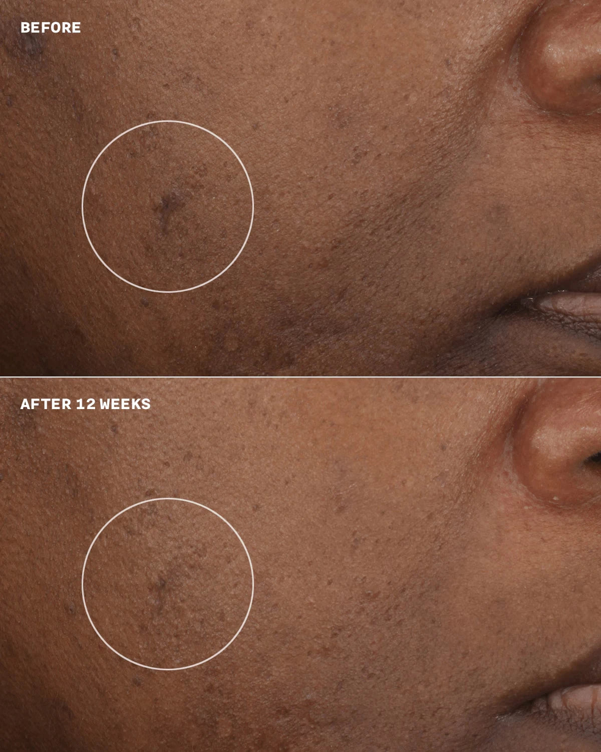 Even Better Clinical™ Brightening Moisturizer - US 3450