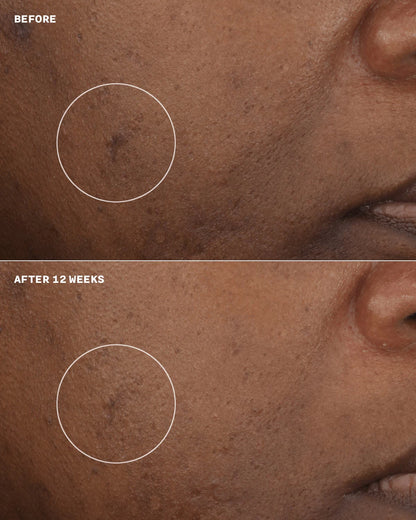 Even Better Clinical™ Brightening Moisturizer - US 3450