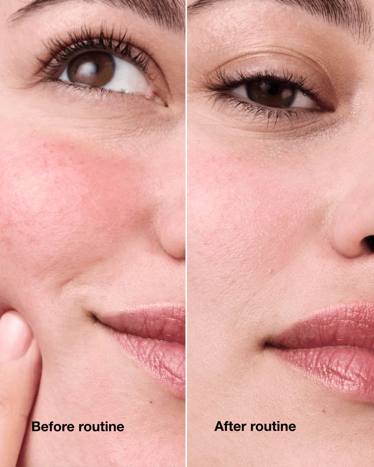 Redness Solutions Redness Regimen - US 7613