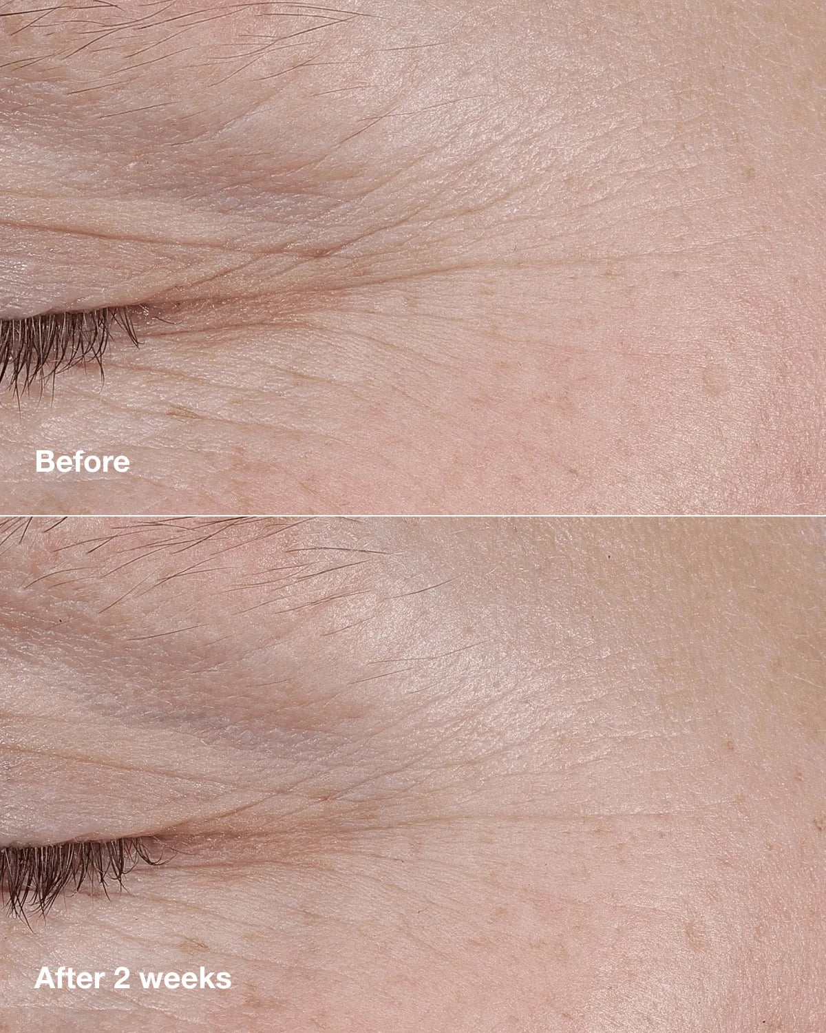 Clinique Smart Clinical Repair™ AM/PM Retinoid Balm - US 5310