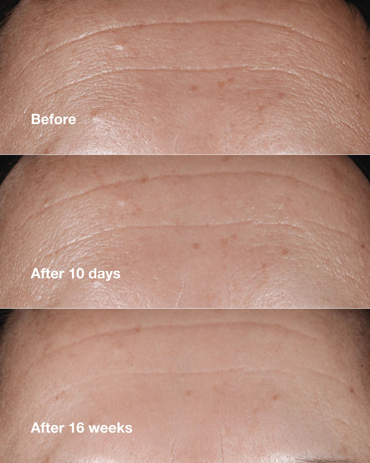 Clinique Smart Clinical Repair™ Wrinkle Correcting Serum - US 8116